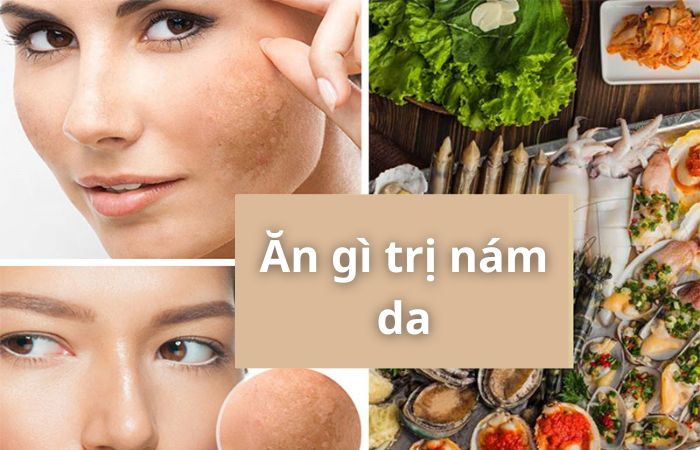 Ăn gi trị nám da
