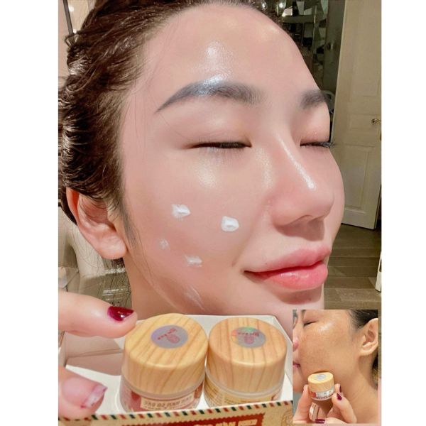 kem-nam-que-skin kem trị nám Quê Skin