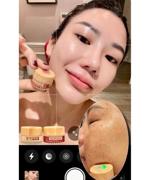 Phản hồi của khách về Kem trị nám Quê Skin