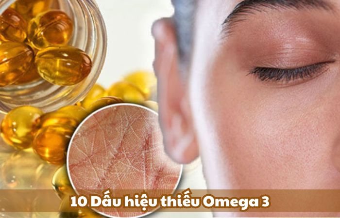 10 Dấu hiệu và triệu chứng thiếu Omega 3