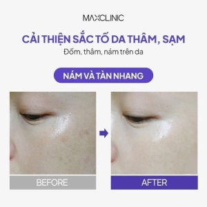 Kem Dưỡng Mờ Nám MAXCLINIC - Melatonin Liposome