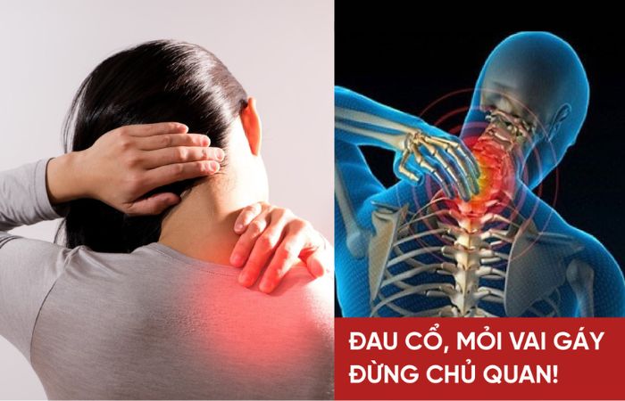 nguyên nhân đau mỏi ở dân văn phòng